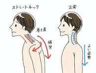 ストレートネックについて　大津市　石山　石山東洋鍼灸整骨院