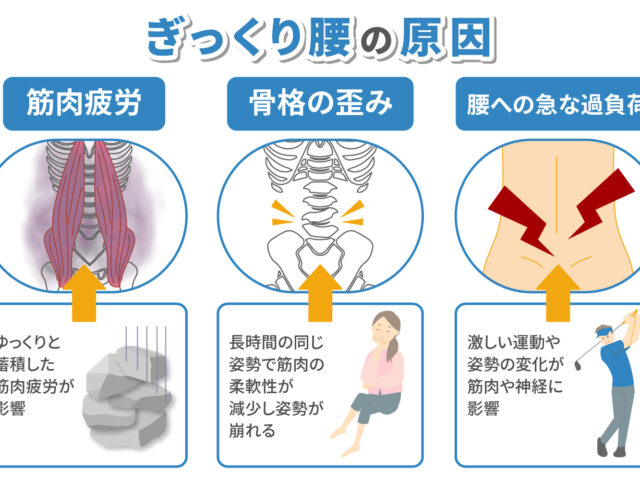 ギックリ腰に注意！大津市石山東洋鍼灸整骨院
